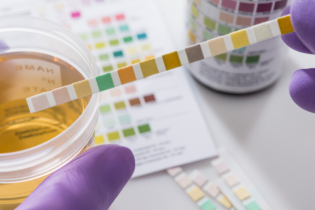 Lawrence Aseba Tipo mostra como a análise da urina pode revelar sinais importantes sobre a sua saúde.